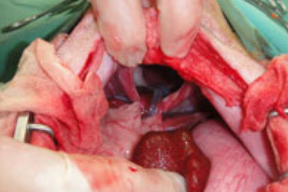 手術中、横隔膜の穴が開いた部分から心臓が確認できます。